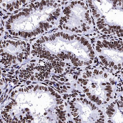 NRF1 Recombinant Rabbit mAb (S-2409-103)