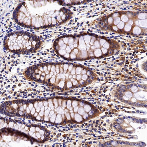 PKM2 Rabbit Polyclonal antibody