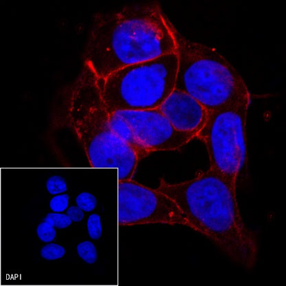 E-Cadherin Recombinant Rabbit mAb (Alexa Fluor® 555 Conjugate) (S-438-5)