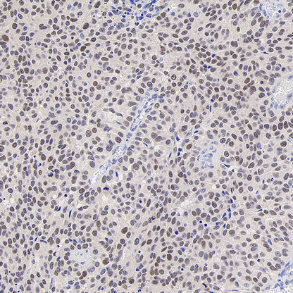 Chk2 Recombinant Rabbit mAb