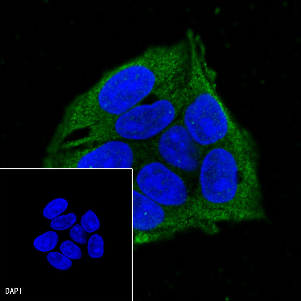 IGFBP1 Recombinant Rabbit mAb (SDT-196-47)