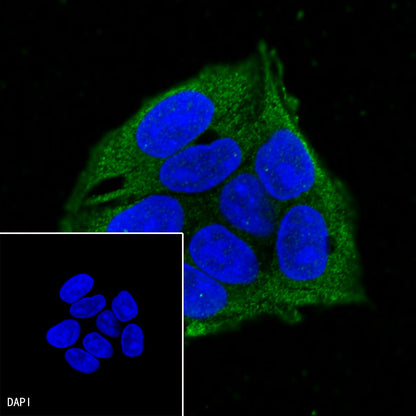 IGFBP1 Recombinant Rabbit mAb (SDT-196-47)