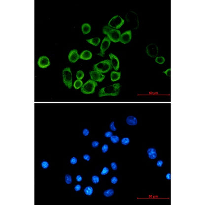 eIF2A Recombinant Rabbit mAb