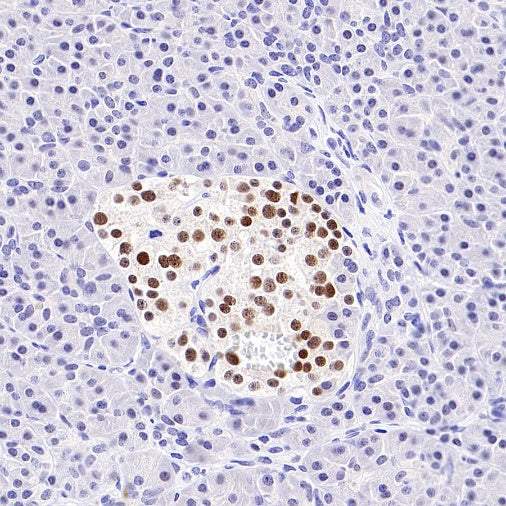 INSM1 Recombinant Rabbit mAb (SDT-3165-72)