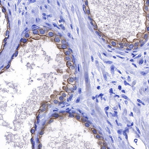 ErbB4 Recombinant Rabbit mAb (S-496-61)