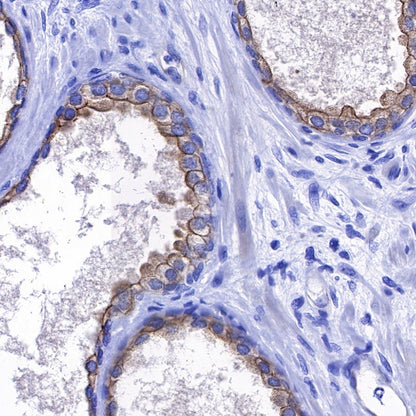 ErbB4 Recombinant Rabbit mAb (S-496-61)