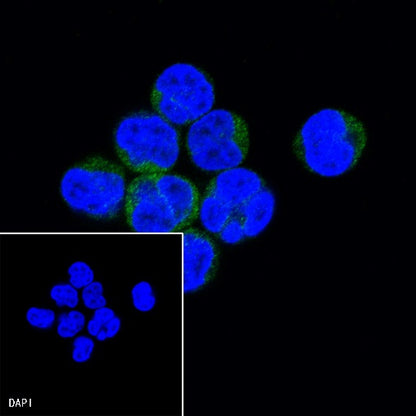 CD25/IL-2Rα Recombinant Rabbit mAb (S-R223)