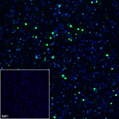 DLX5 Recombinant Rabbit mAb (S-2785-79)