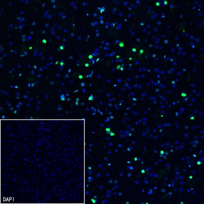 DLX5 Recombinant Rabbit mAb (S-2785-79)