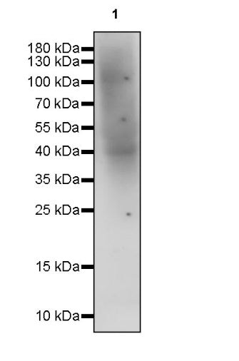 Man6P Recombinant Rabbit mAb (S-2745)