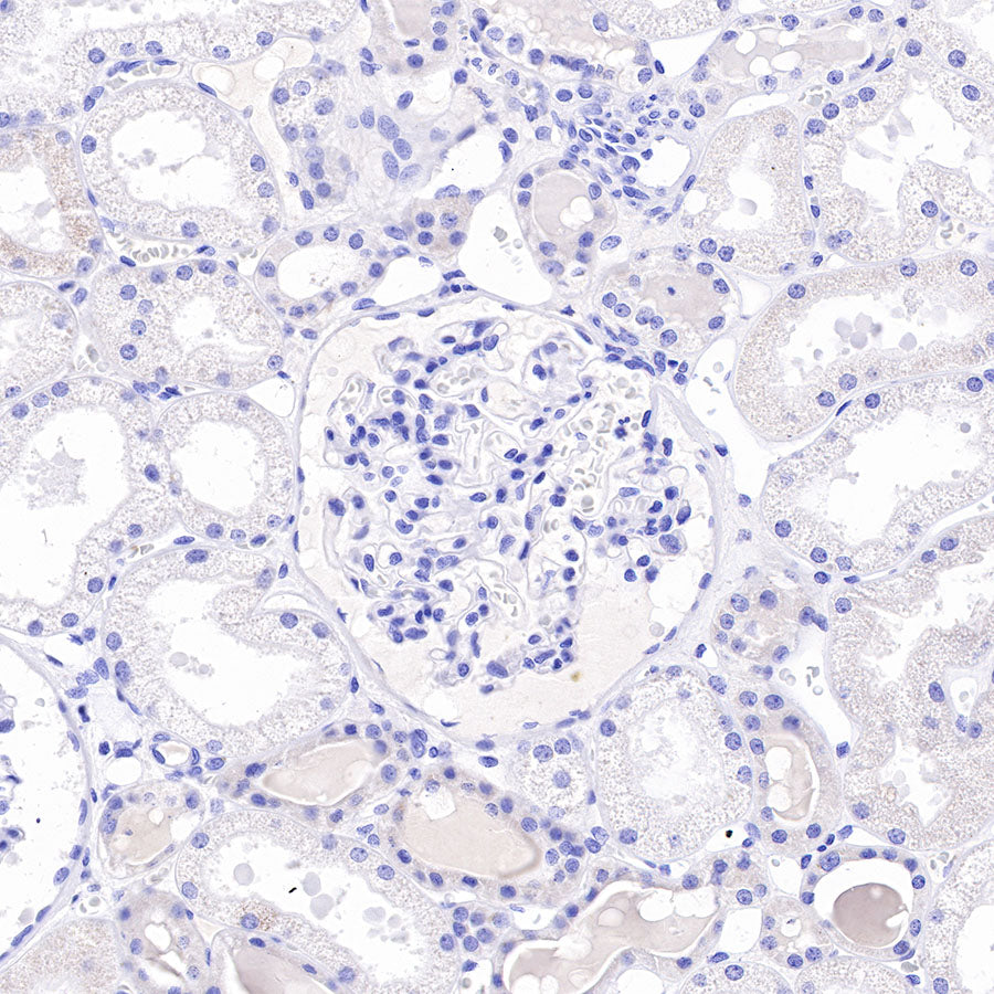 Asialoglycoprotein Receptor 1 Recombinant Rabbit mAb (SDT-292-48)