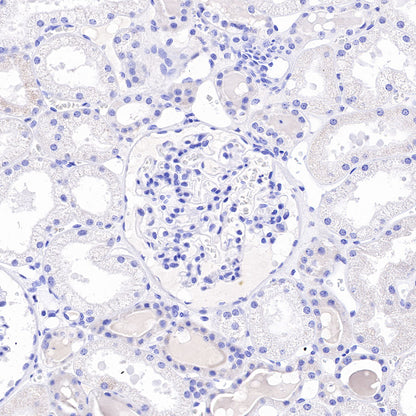 Asialoglycoprotein Receptor 1 Recombinant Rabbit mAb (SDT-292-48)