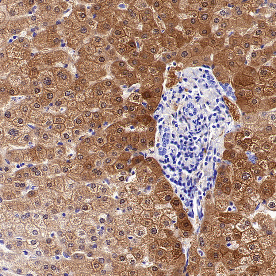 NNMT Recombinant Rabbit mAb (S-3470-58)