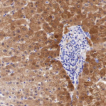 NNMT Recombinant Rabbit mAb (S-3470-58)
