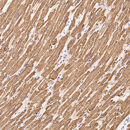 MYH7 Recombinant Rabbit mAb (SDT-2936-44)