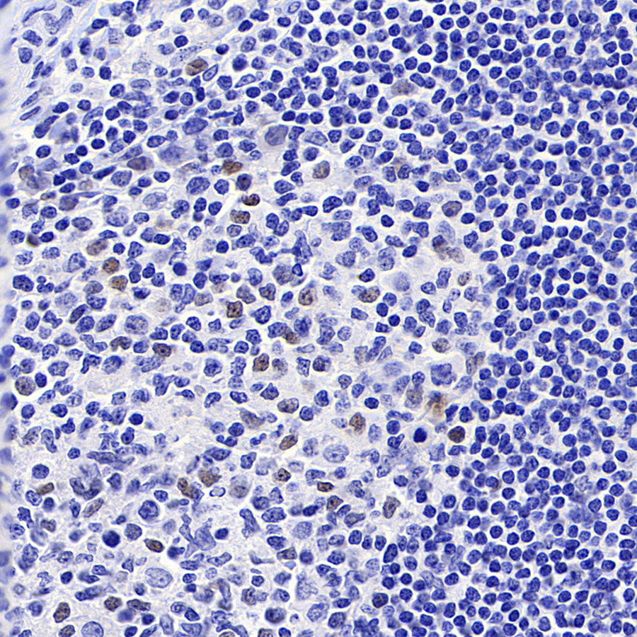 Cyclin E2 Recombinant Rabbit mAb (S-5247)