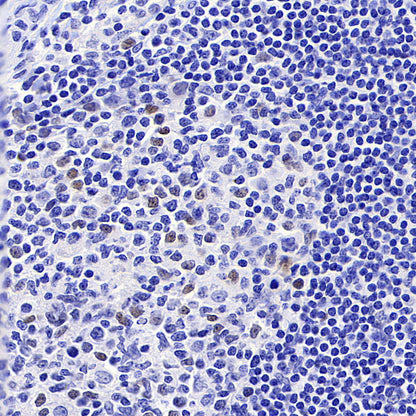 Cyclin E2 Recombinant Rabbit mAb (S-5247)