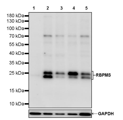 RBPMS Recombinant Rabbit mAb (S-2387-163)