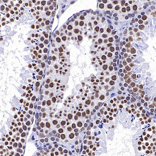 Goat Anti-Rat IgG(H+L) (HRP Conjugate)