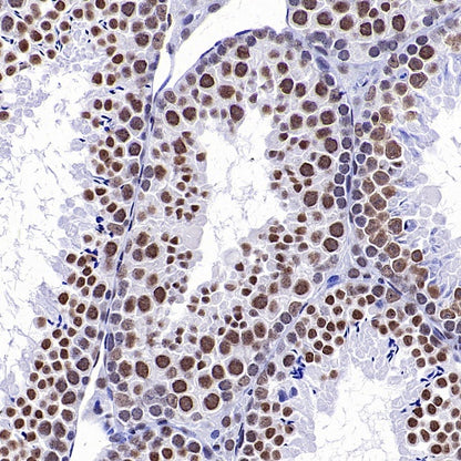 Goat Anti-Rat IgG(H+L) (HRP Conjugate)