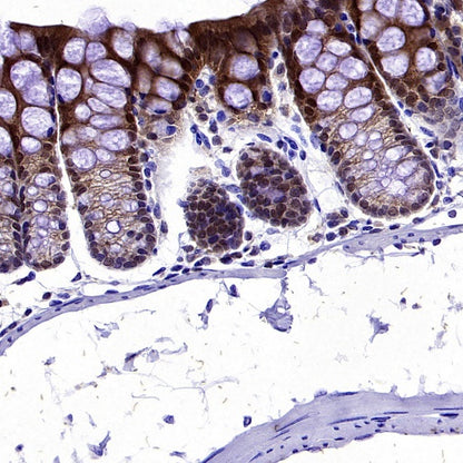 pro-Caspase-1 Recombinant Rabbit mAb (S-2677-22)