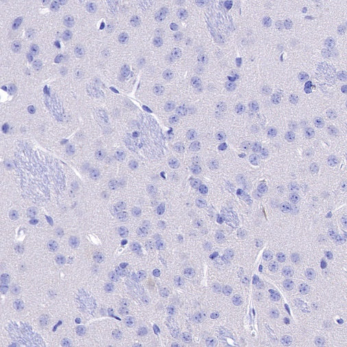 CD3ε Recombinant Rabbit mAb (S-300-125)