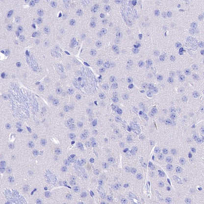 CD3ε Recombinant Rabbit mAb (S-300-125)