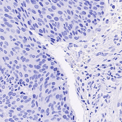 MUC5AC Recombinant Rabbit mAb, PBS Only (SDT-2630-23)