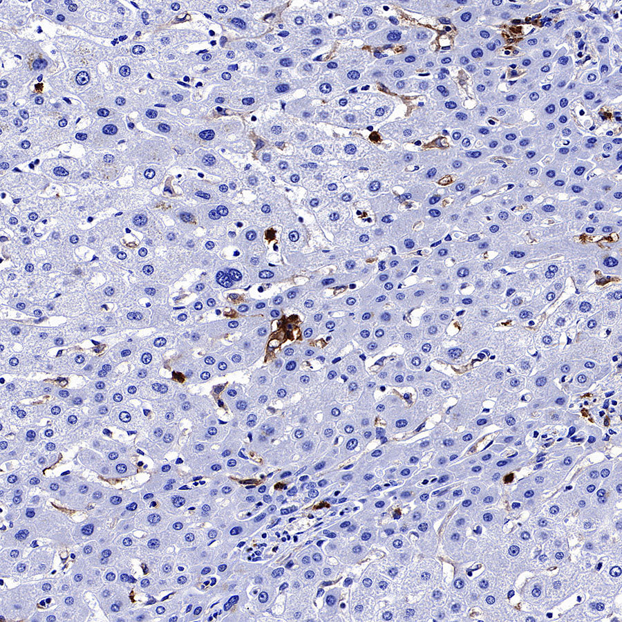 uPAR/CD87 Recombinant Rabbit mAb (S-3960-82)