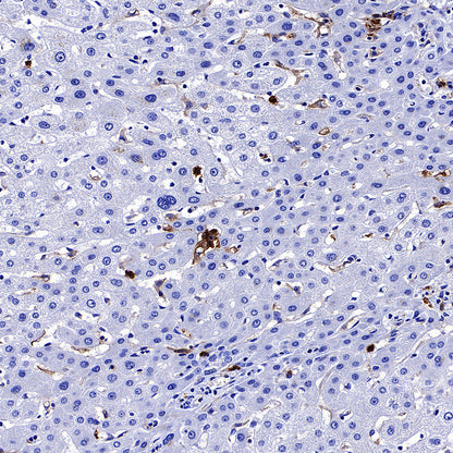 uPAR/CD87 Recombinant Rabbit mAb (S-3960-82)