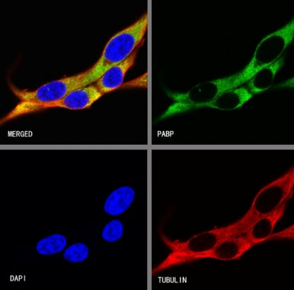 PABP Recombinant Rabbit mAb (S-1744-42)