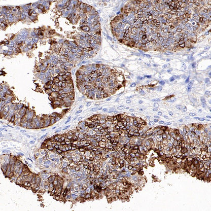 CD57 Mouse mAb (S-R571)