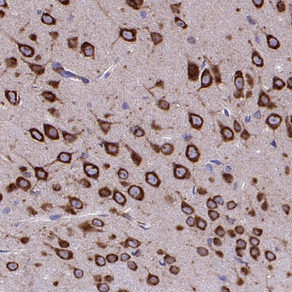 YTHDF1 Recombinant Rabbit mAb (S-2443-28)