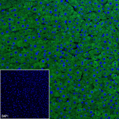 ALDH1L1 Recombinant Rabbit mAb (S-2885-49)