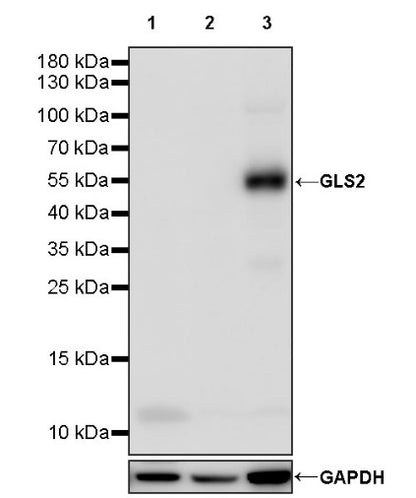 GLS2 Rabbit Polyclonal Antibody