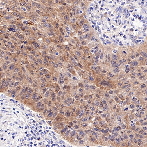 NDRG2 Recombinant Rabbit mAb (S-618-76)