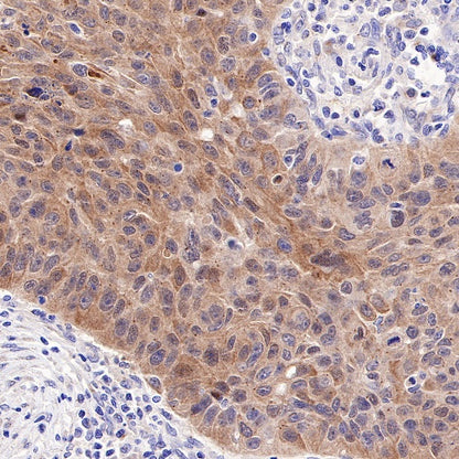 NDRG2 Recombinant Rabbit mAb (S-618-76)