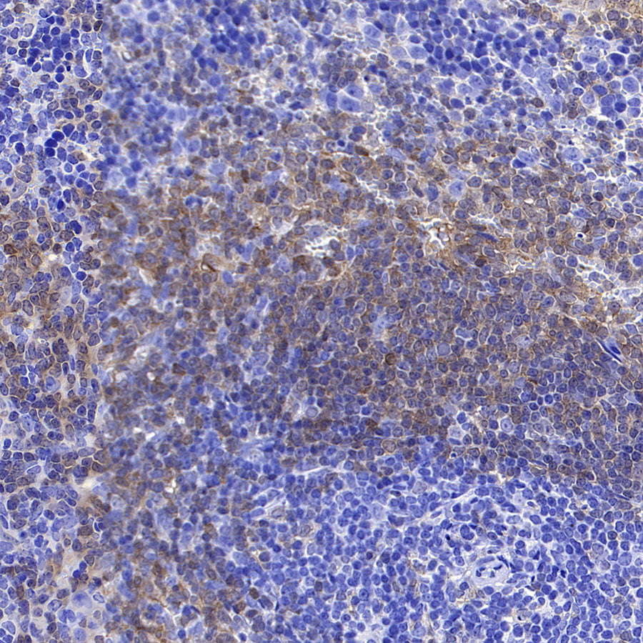 Syk Recombinant Rabbit mAb (S-4400-11)