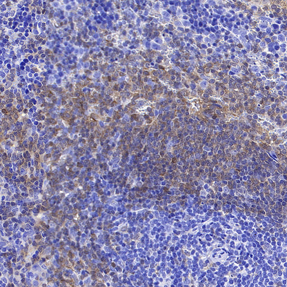 Syk Recombinant Rabbit mAb (S-4400-11)