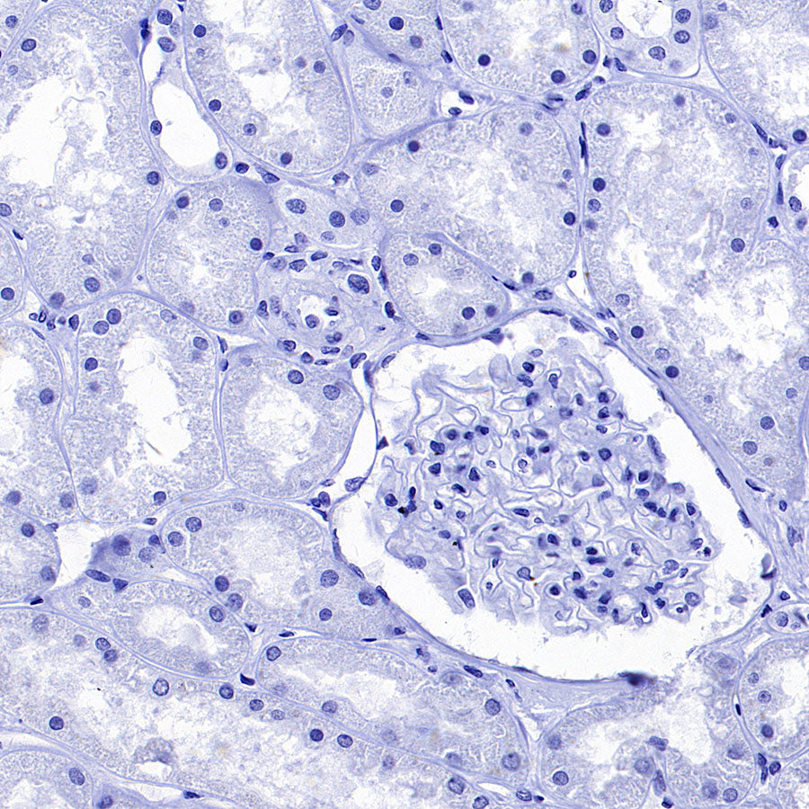 AGXT Recombinant Rabbit mAb (S-3586-30)