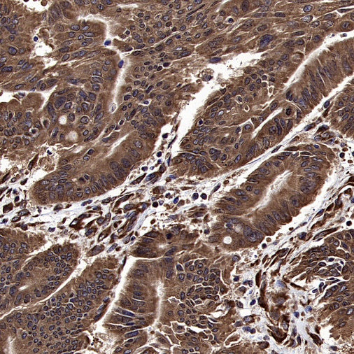 GSPT1 Recombinant Rabbit mAb (S-1914-49)