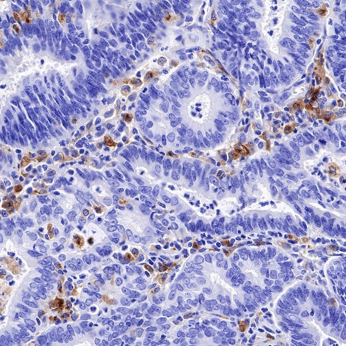 GPNMB Recombinant Rabbit mAb (S-491-6)