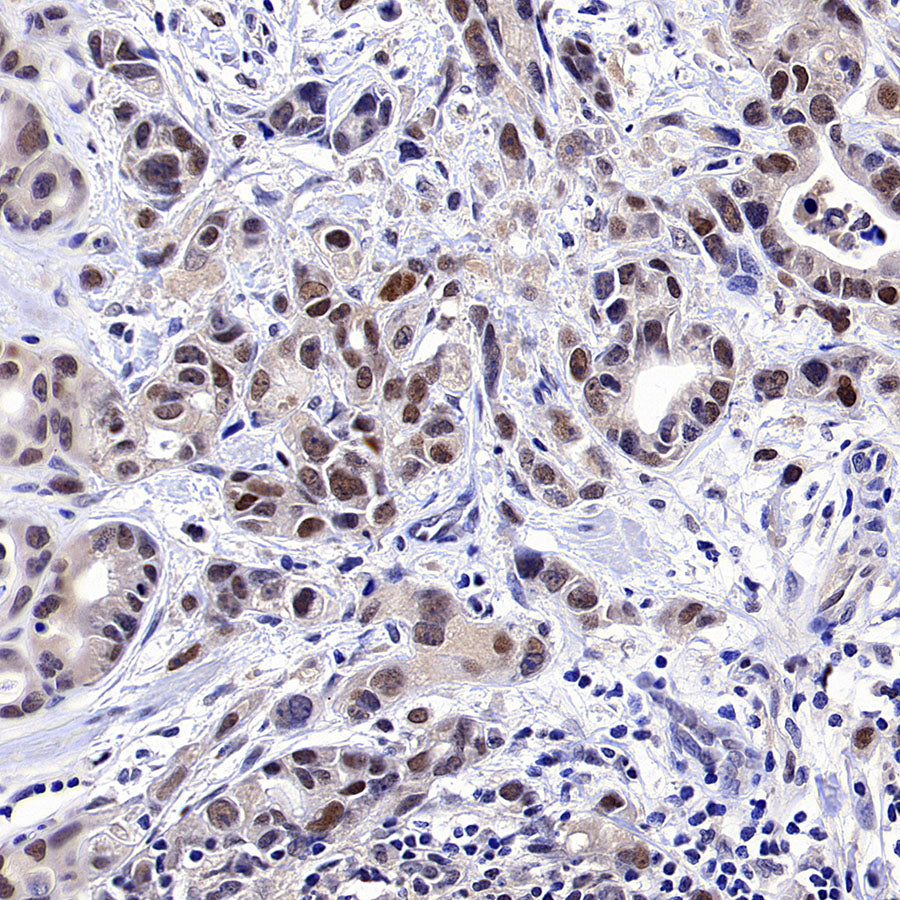 PAPSS1 Recombinant Rabbit mAb (S-3516-9)