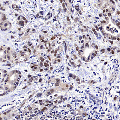 PAPSS1 Recombinant Rabbit mAb (S-3516-9)