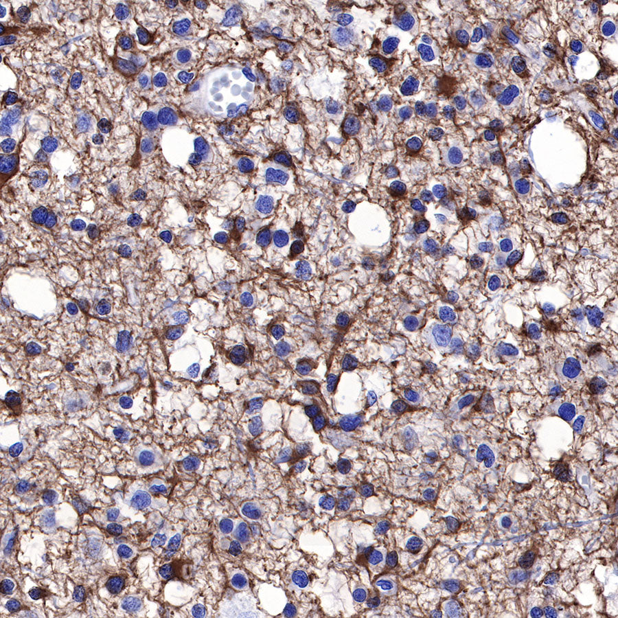 GFAP Recombinant Rabbit mAb (SDT-306-10)