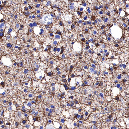 GFAP Recombinant Rabbit mAb (SDT-306-10)