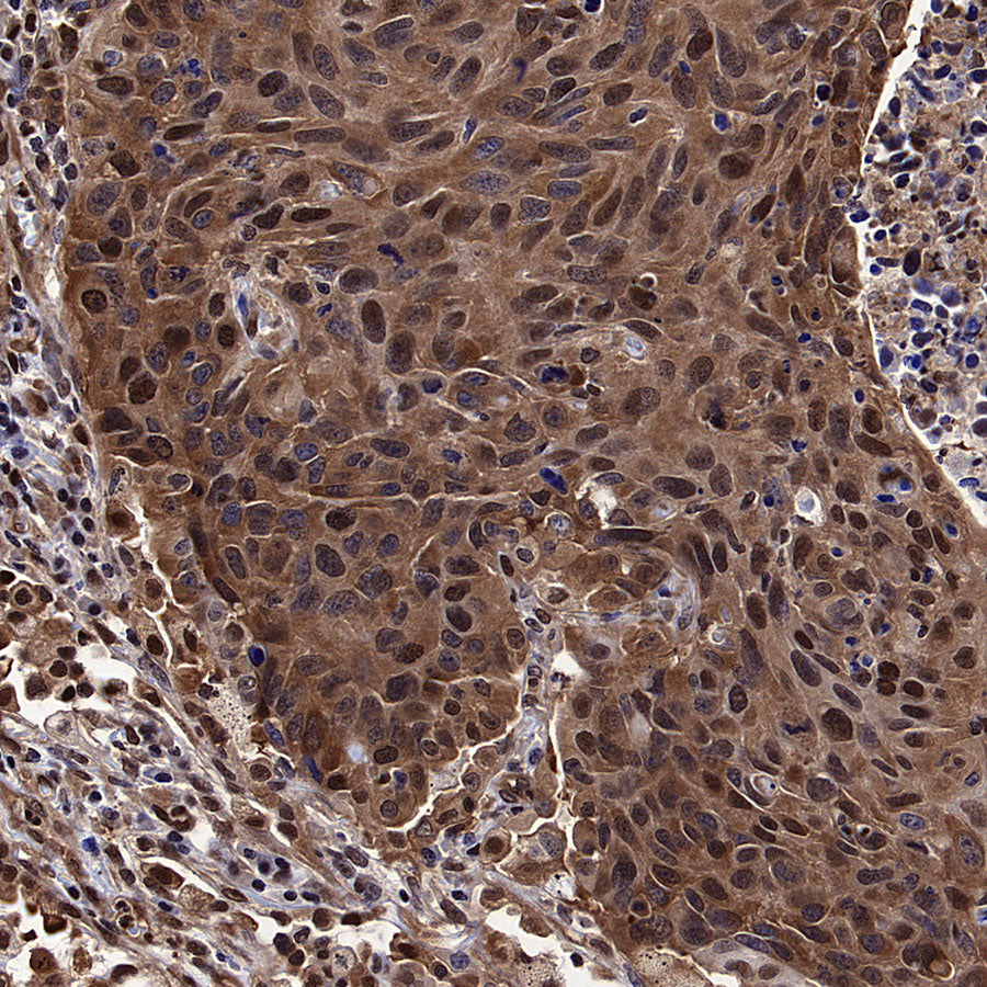 ATP Citrate Lyase Recombinant Rabbit mAb (S-5036)