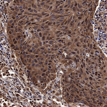 ATP Citrate Lyase Recombinant Rabbit mAb (S-5036)