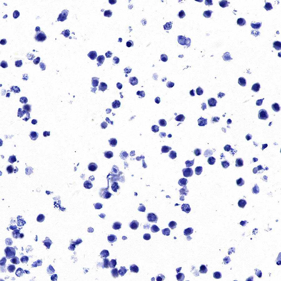 STEAP1+STEAP1B1+STEAP1B2 Recombinant Rabbit mAb (S-3226-137)