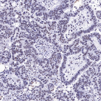 U2AF2 Recombinant Rabbit mAb (S-1324-1)